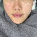 대한유지 | 온다리프팅6만줄 받고 한달, 유지기간과 변화 솔직 후기
