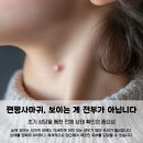 부천플랜에이보습학원 | 부천편평사마귀 제거 무제한 후기 궁금하다면