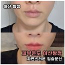 용머리길 | 아산 입술문신 피부온도 자연스러운 붉은톤 일주일 후기