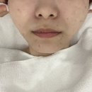 아누보스킨 이미지