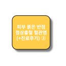 피부 붉은 반점 점상출혈 혈관염 증상 (+진료후기)②