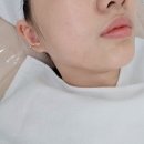 디알 에스터