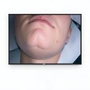 생생척척의원 | 인생 치아 고민 드디어 접수 완료!