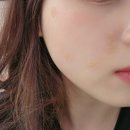 예쁨의정석의원 네이버블로그