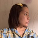 미용실리인 | 압구정역 피부과 조각주사 효과 2회차 내돈내산 후기