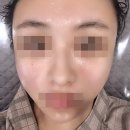 세종피부과? 세종피부관리샵! 아르드뽀에스테틱에서 아쿠아필+오투덤테라피받고 온 리얼 후기~!