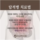 배꼽위배통증, 배꼽위배통증의 원인과 치료 이미지