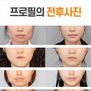 프로필성형외과의원 네이버블로그