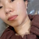 튠페이스 튠라이너 주기 맞춰 타임락튠 시술받은 후기