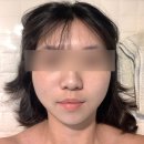 군산 피부관리: 레이드스킨 산소테라피 후기