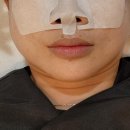 에그뮤즈 스킨스칼프 이미지