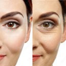 신갈한의원 이미지