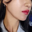 [신사] 압구정 신사피부과 포텐자콜라스터 피부관리 후기