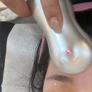 홍 헤어라인 이미지