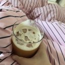 심사숙고 | [후기]급발진 쌍수 후기 (부제:쌍수는 심사숙고하자)