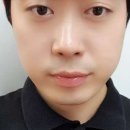 첨(CHEOM)