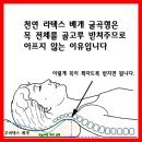 목 통증 때문에 잠을 잘 못자겠어요. 이미지