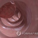 암세포 파괴 대신 정상으로 되돌린다…국립암센터 새 치료법 제시 이미지