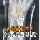 요골 | 손목 골절 수술과 입원 후기 -원위요골, 척골 골절 플레이트 삽입 경험담