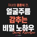 아이비성형외과의원 네이버블로그