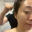 [분당] 재생림프/동안윤곽관리 벨라인 에스테틱 서현점 1회 솔직후기(+주차정보 및 관리과정)