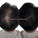 6831 | 대구 남자헤어라인 잘하는곳이 궁금하다면? 후기까지 좋은지 체크해보세요