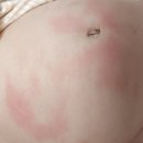 검단 위키즈 병원 후기 / 알레르기 반응 / 6개월 아기 / 육아 기록