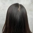 반포온가족의원 | 동작 두피문신부터 신반포까지, 휑한 정수리 고민 해결하고 온 찐 후기!