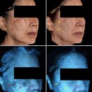 헬리오스 이미지