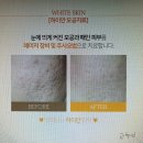 화명동피부과 후기가 궁금하시다면!
