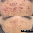 (주)구띠 | 하남미사 피부관리, 구띠끄에서 피부가 나를 반기기 시작했다