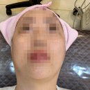 광하약국 | D - 185 결혼 준비 피부 시술하기