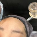 청주피부관리 이츠제이 청주점에서 물광폭탄