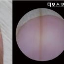 손톱 검은 세로줄 원인 예방 내 몸이 보내는 적신호일까? 이미지