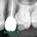 광명치과기공소 이미지