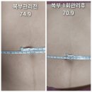 위더스동물병원 | [안양/군포산후마사지] 출장산후마사지 추천 위더스 산후케어 안양점 내돈내산후기
