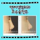 앤써성형외과의원 이미지