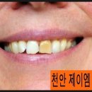 제이엠치과 이미지