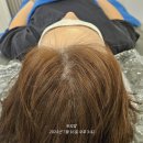 영통구 영통동 996-2~996-4 (영통대우월드마크 수원우편집중국 사잇길) | 영통탈모 두피밥에서 만족했던 케어 관리 받은 후기