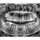 명성치과기공소 이미지