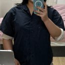 멍발머리 | 신사역지방추출주사 팔뚝 대용량 아웃핏주사 상담부터 2주차 후기! (멍, 붓기, 실밥 제거, 통증)