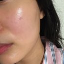 진정슈퍼 | [피부진정 치트키] 속건조 잡는 98% 알로에베라 프리미엄 슈퍼겔 진정수분젤 찐사용후기🌿