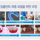 금호기공소 이미지