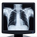 상쾌한장문외과의원 | 관절이 삐걱대서 덜컥 등록한 후기