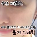 서면 윤에스테틱, 세멘시트로 여드름/모공/피지 관리(전후사진有)