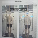 광명에스테틱 스페이스뷰티 AK광명 체형관리 전후비교 후기