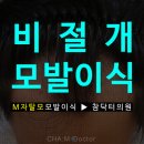 남자 M자탈모 고민 ▶ 비절개모발이식 잘하는 병원과 함께하세요 :D 이미지