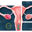 동일1차4가 이미지