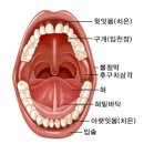 구강암 이미지