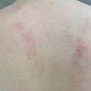 수원출장산후마사지 &#34;미소맘 산후케어&#34; 받아본 솔직후기